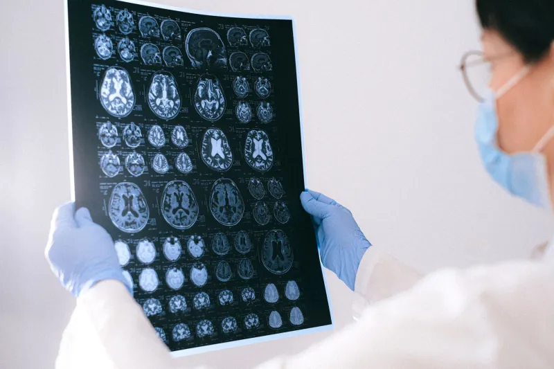 Does MK-677 Actually Sharpen the Mind? Evaluating the Neurological Evidence Behind Growth Hormone and Cognitive Performance